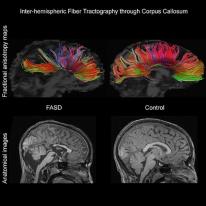4 brain scans